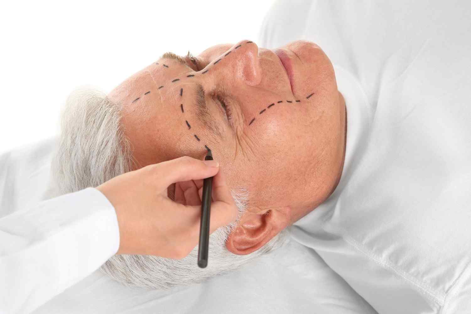 https://www.medexcon.com/wp-content/uploads/2017/08/cosmetic-surgery-blog-03.jpg
