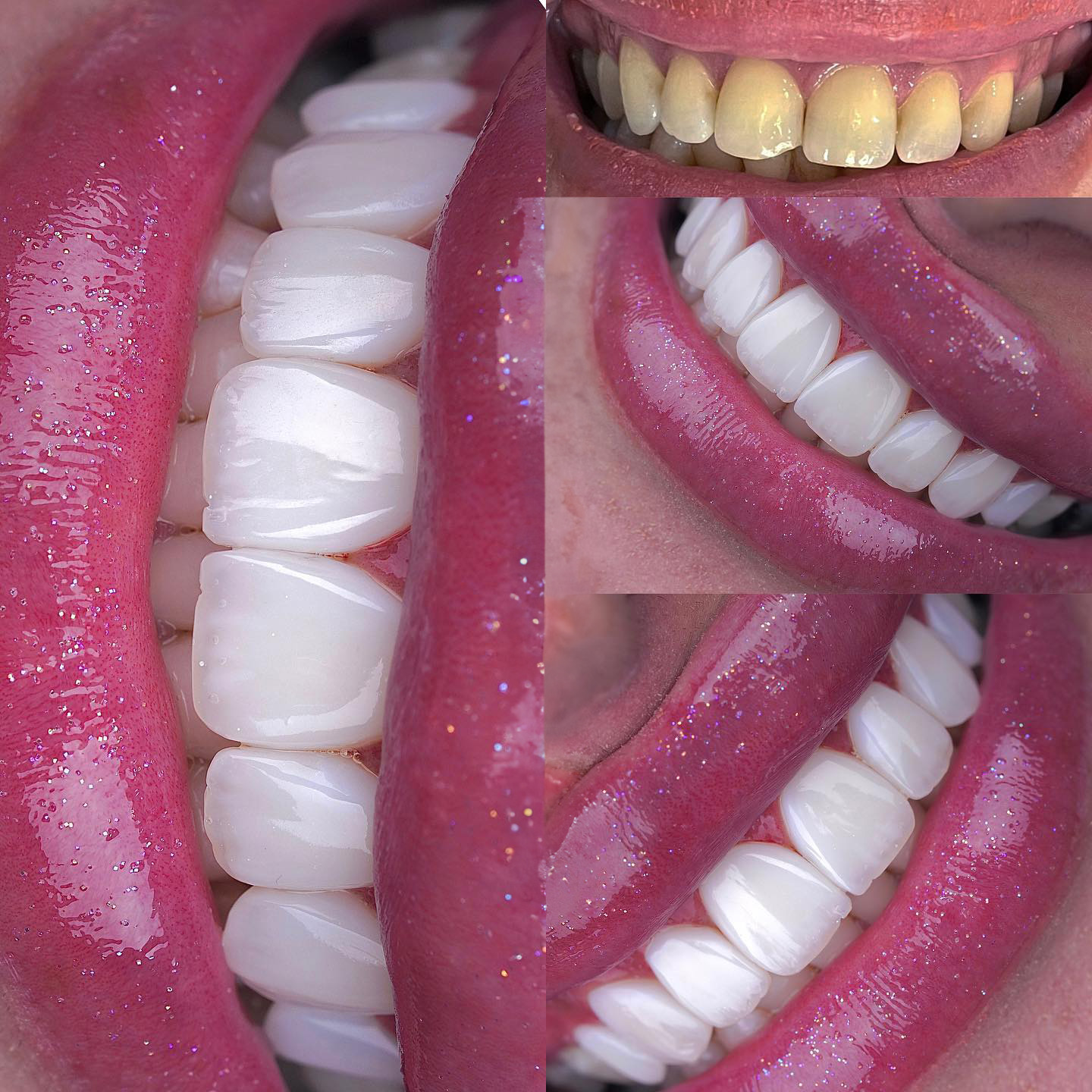 d145